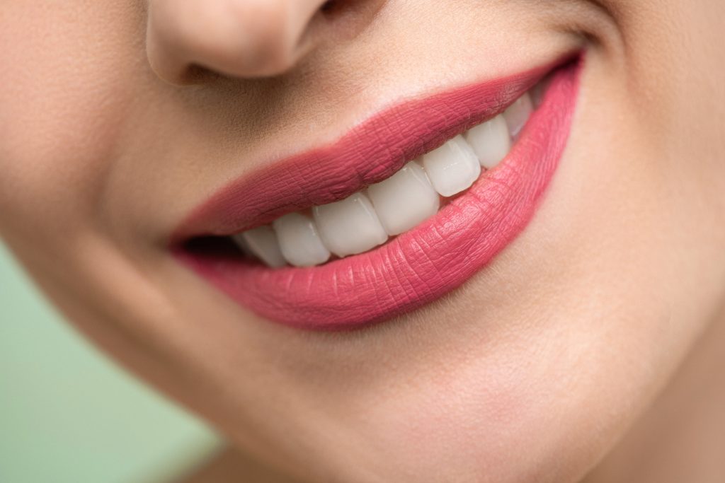 The most common teeth problems veneers can correct