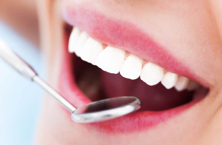Close up of bright, white, healthy teeth in Pineville, NC.