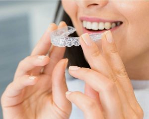 Invisalign Clear Aligners in Pineville and Salisbury, NC: Are They Right for You?