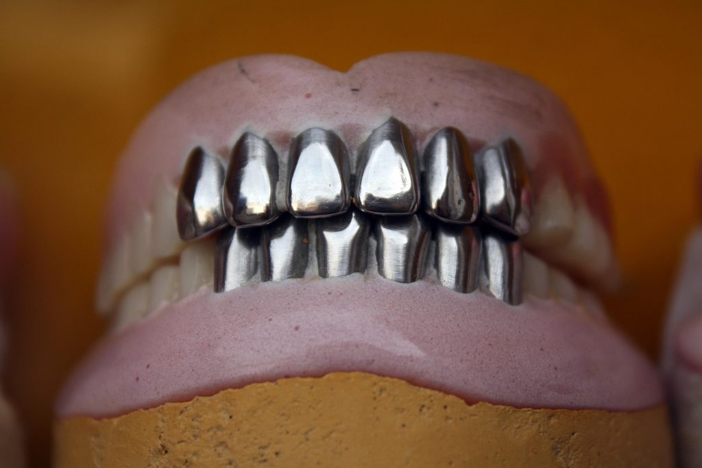 Learn everything about dental crowns in Salisbury and Pineville, including their uses, costs, and procedure. Discover how our dentists restore damaged teeth with durable crowns. Call now!
